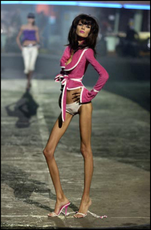 anorexic-model-4.jpg